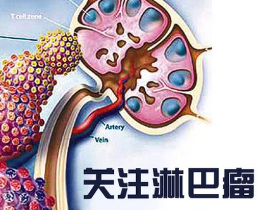 世界十大痛苦癌癥排行，胃癌發病率高，肺癌死亡率最快