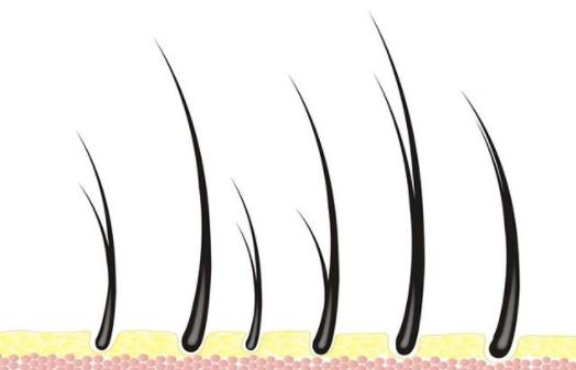 女性剃掉陰毛好嗎？女人私處陰毛多正常嗎？女人私處體毛有什么作用