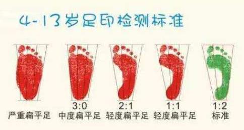 扁平足能跑步嗎？扁平足跑步有什么危害？